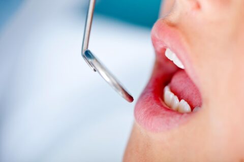 Dental Cleaning and Prevention